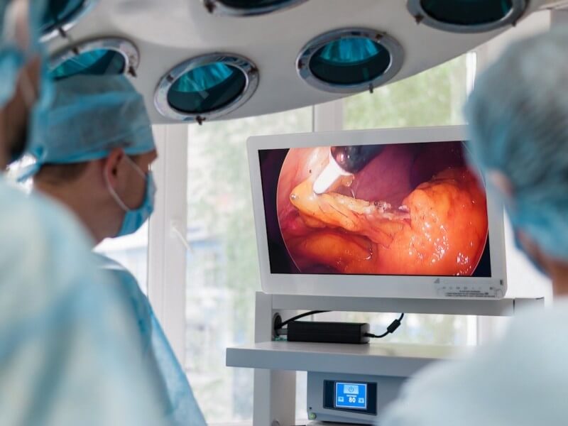 endoscopia